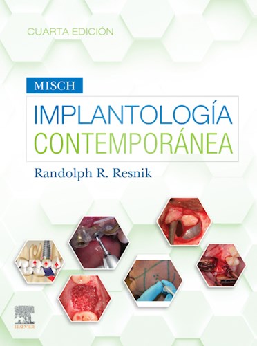 Misch  Implantología Contemporánea