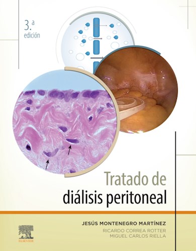 E-book Tratado de diálisis peritoneal