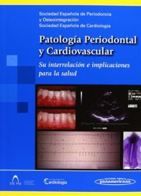 Papel Patología Periodontal y Cardiovascular