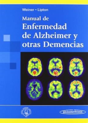 Papel MANUAL DE ENFERMEDAD DE ALZHEIMER Y OTRAS DEMENCIAS