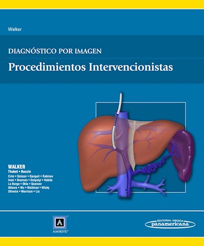 Papel Diagnóstico por Imagen: Procedimientos Intervencionistas