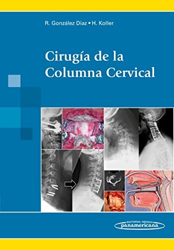 Papel Cirugía de la Columna Cervical