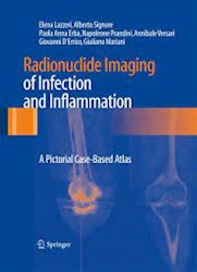 Papel Radionuclide Imaging Of Infection And Inflammation: A Pictorial Case-Based Atlas