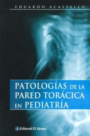 Papel Patologias De La Pared Toracica En Pediatria