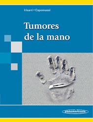 Papel Tumores De La Mano