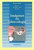 Papel IMAGENES EN GINECOLOGIA (ED/1999) (CARTONE)
