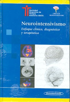 Papel Neurointensivismo