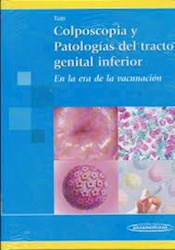 Papel Colposcopia Y Patologías Del Tracto Genital Inferior