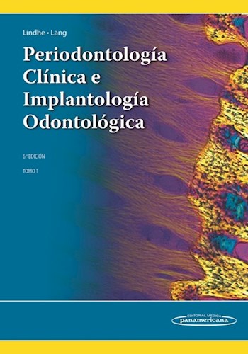Papel PERIODONTOLOGIA CLINICA E IMPLANTOLOGIA ODONTOLOGICA (TOMO 1) (6 EDICION) (CARTONE)
