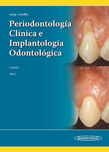 Papel PERIODONTOLOGIA CLINICA E IMPLANTOLOGIA ODONTOLOGICA (TOMO 2) (6 EDICION) (CARTONE)