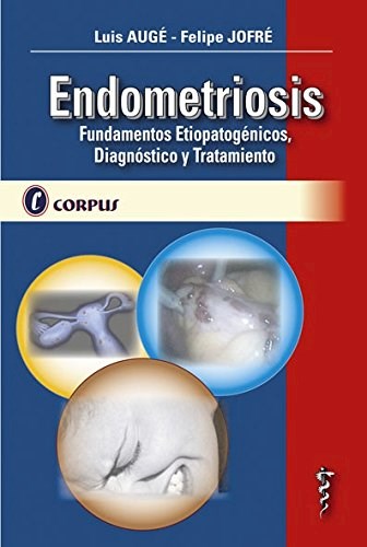 Papel Endometriosis Fundamentos Etiopatogenicos