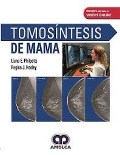 Papel Tomosíntesis de Mama
