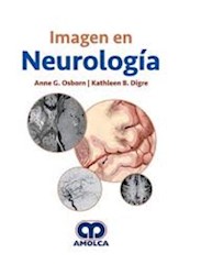 Papel Imagen En Neurología