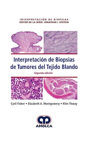 Papel Interpretación de Biopsias de Tumores del Tejido Blando Ed.2