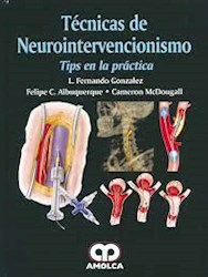 Papel Técnicas De Neurointervencionismo. Tips En La Práctica