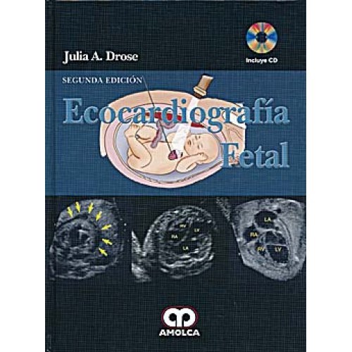 Papel Ecocardiografia Fetal