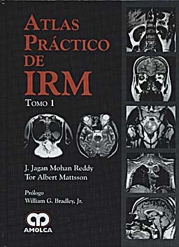 Papel Atlas Práctico de IRM (2 Vols.)