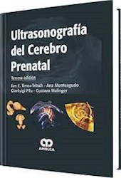 Papel Ultrasonografía Del Cerebro Prenatal Ed.3º
