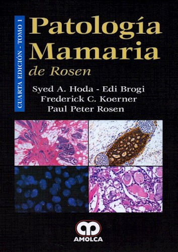 Papel Patología Mamaria de Rosen