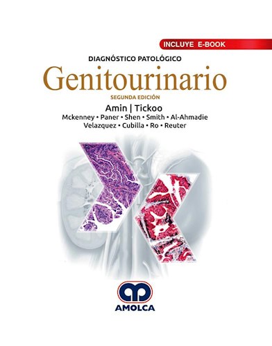 Papel Diagnóstico Patológico. Genitourinario Ed.2