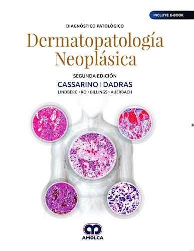 Papel Dermatopatología Neoplásica Ed.2