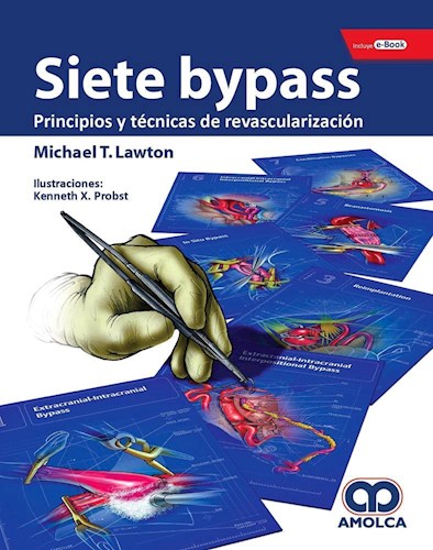 Papel Siete Bypass