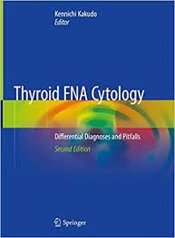 Papel Thyroid Fna Cytology: Differential Diagnoses and Pitfalls