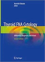 Papel Thyroid Fna Cytology: Differential Diagnoses And Pitfalls