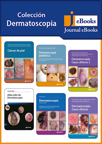E-Book Colección Dermatoscopia (eBook)