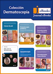 E-Book Colección Dermatoscopia (Ebook)