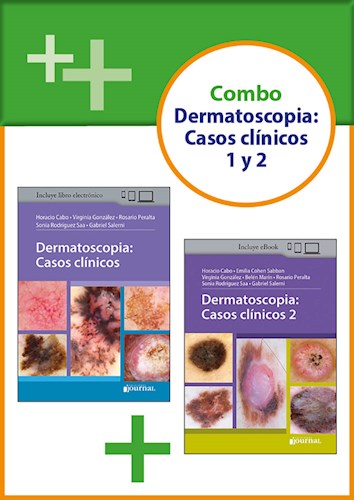  Combo Dermatoscopia  Casos Clínicos  1 Y 2
