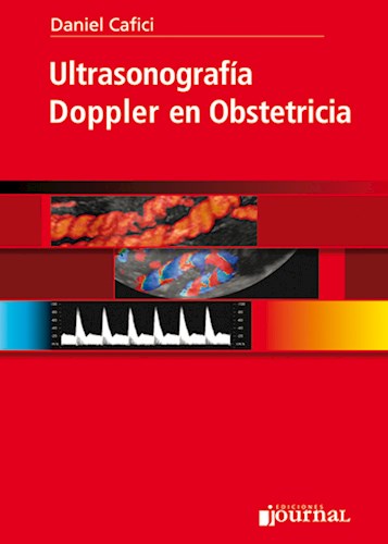  Ultrasonografía Doppler en Obstetricia