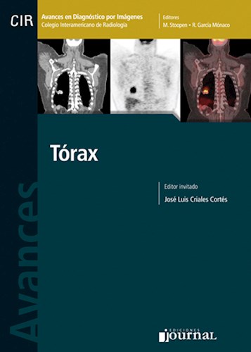  Avances en Diagnóstico por Imágenes  Tórax