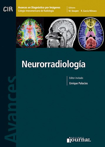  Avances en Diagnóstico por Imágenes  Neurorradiología