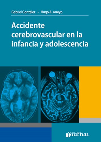 Papel Accidente cerebrovascular en la infancia y adolescencia
