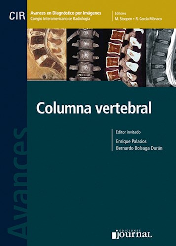 Papel Avances en Diagnóstico por Imágenes: Columna vertebral