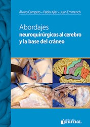 Papel Abordajes Neuroquirúrgicos Al Cerebro Y La Base Del Cráneo