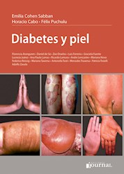 Papel Diabetes Y Piel