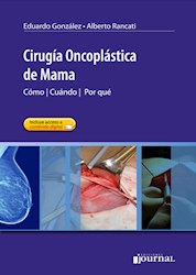 Papel Cirugía Oncoplástica De Mama
