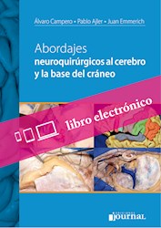 E-Book Abordajes Neuroquirúrgicos Al Cerebro Y La Base Del Cráneo (Ebook)