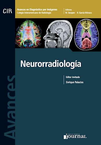E-Book Avances en Diagnóstico por Imágenes: Neurorradiología E-Book