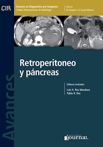 E-Book Avances en Diagnóstico por Imágenes: Retroperitoneo y Páncreas (eBook)
