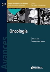 E-Book Avances En Diagnóstico Por Imágenes: Oncología E-Book