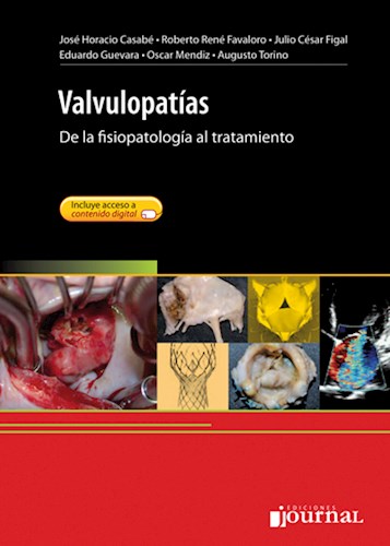  Valvulopatías