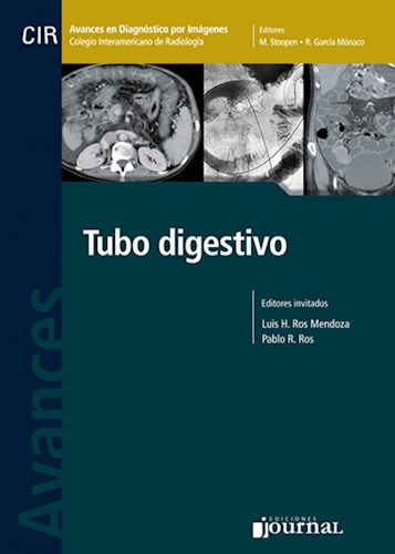 Papel Avances en Diagnóstico por Imágenes: Tubo Digestivo