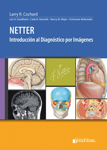 Papel NETTER. Introducción al Diagnóstico por Imágenes