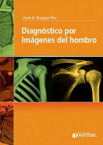 E-Book Diagnóstico por Imágenes del Hombro (eBook)