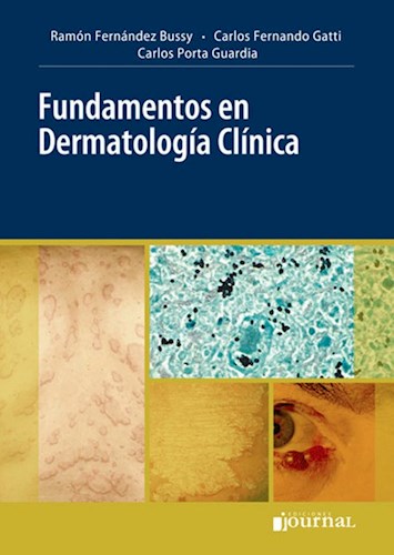 E-Book Fundamentos en Dermatología Clínica (eBook)