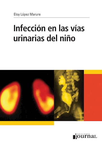 E-Book Infección en las vías urinarias del niño (eBook)