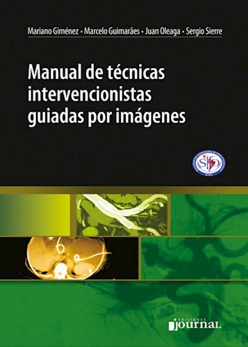 E-Book Manual de técnicas intervencionistas guiadas por imágenes E-Book